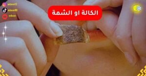 اضرار الكالة او الشمة