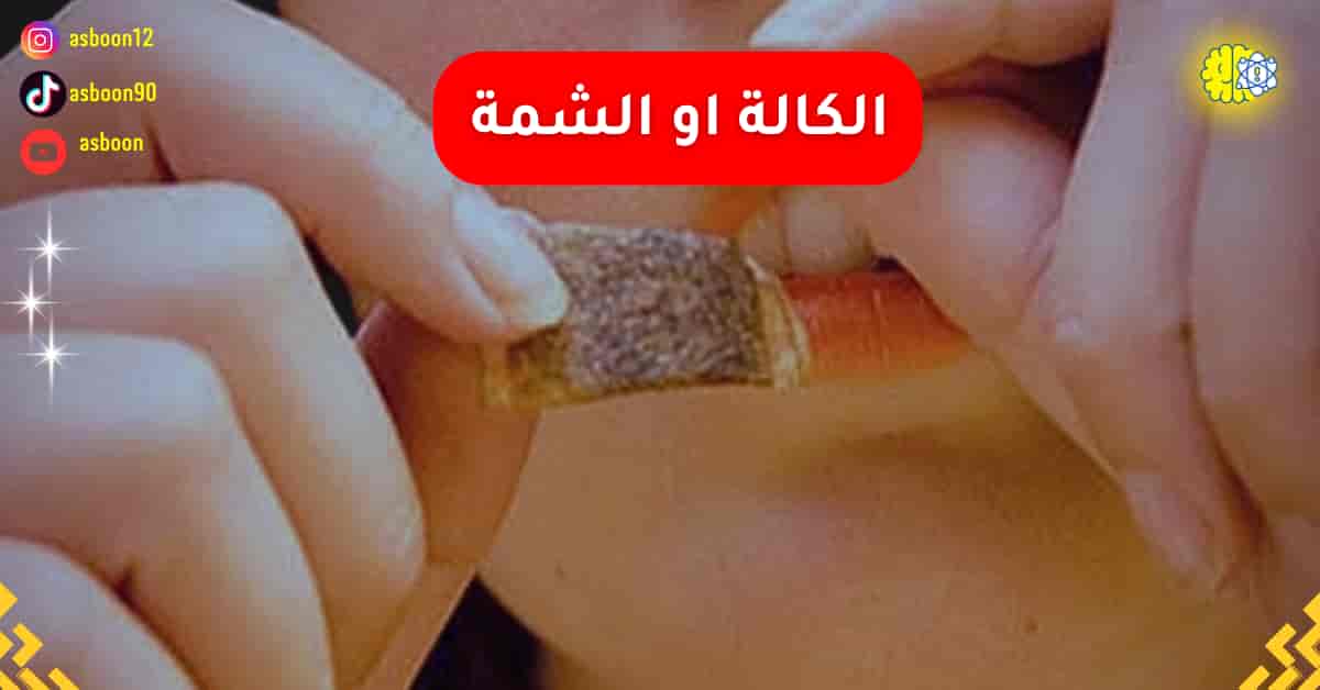 اضرار الكالة او الشمة